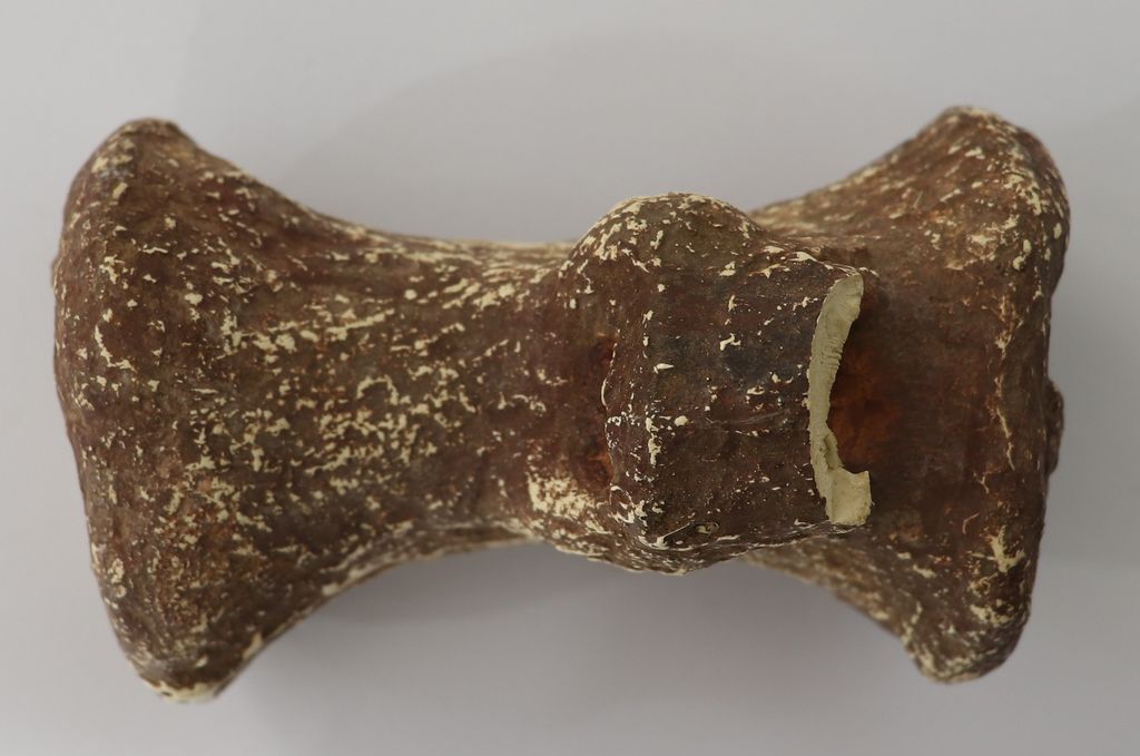 ກະດູກ-ເຂົາ (ປູນປາສເຕີ)